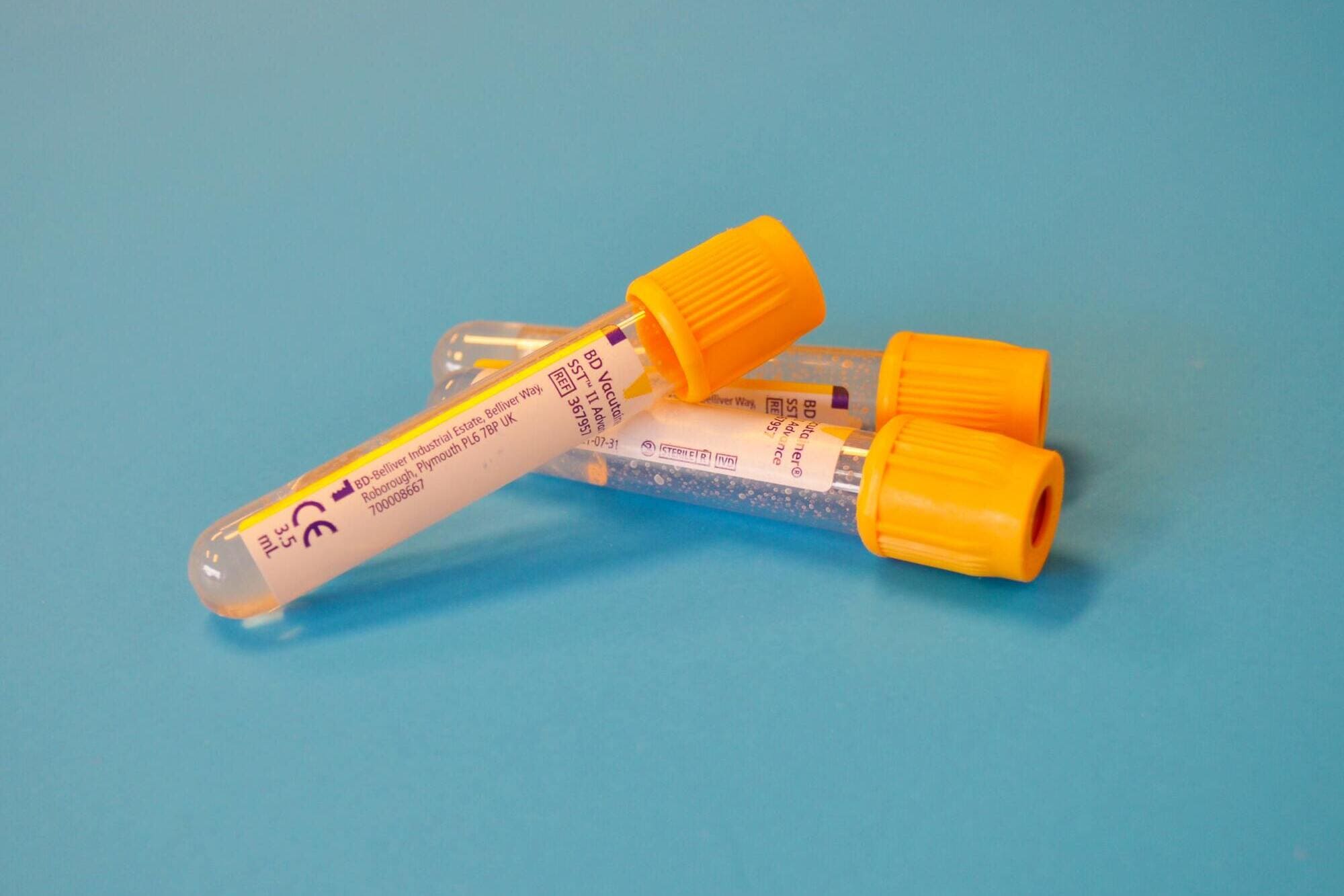 Profilo lipidico
